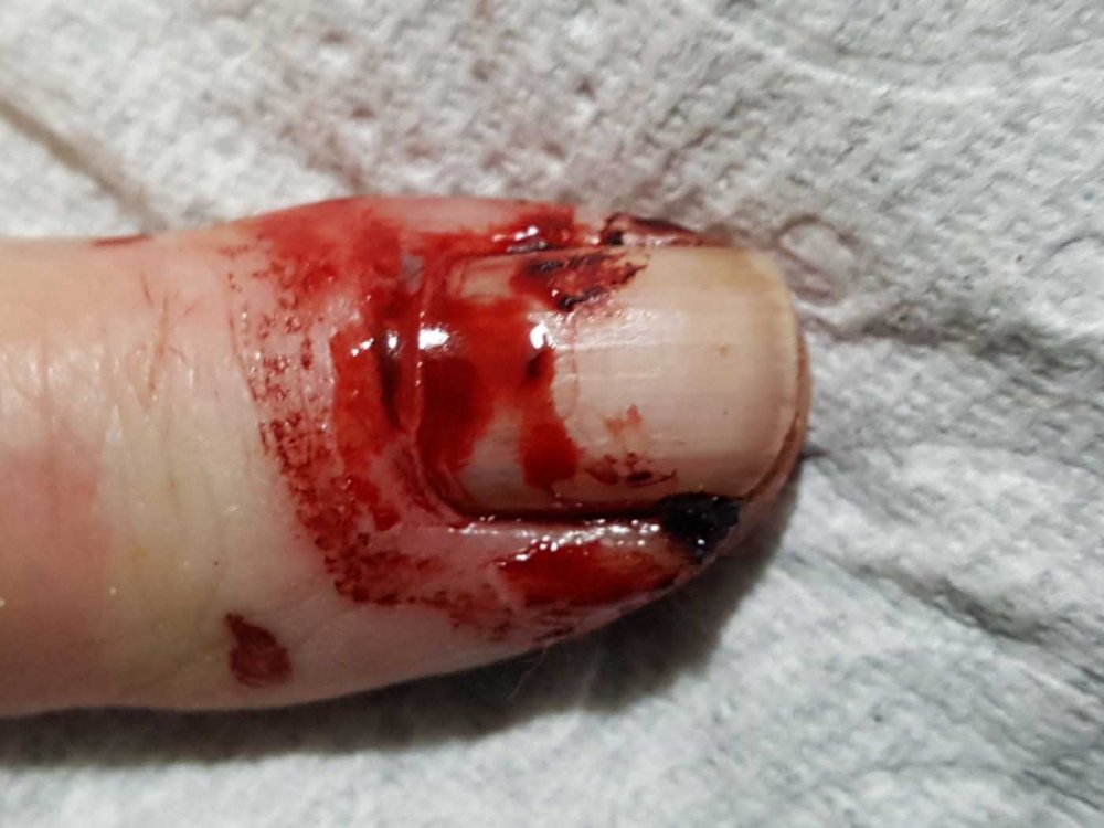 finger 2.jpg